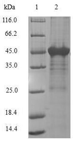 (Tris-Glycine gel) Discontinuous SDS-PAGE (reduced) with 5% enrichment gel and 15% separation gel.