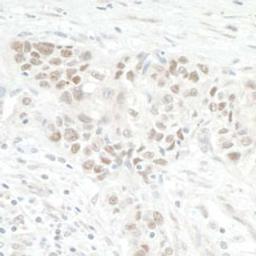 Detection of human NOL12 by immunohistochemistry.