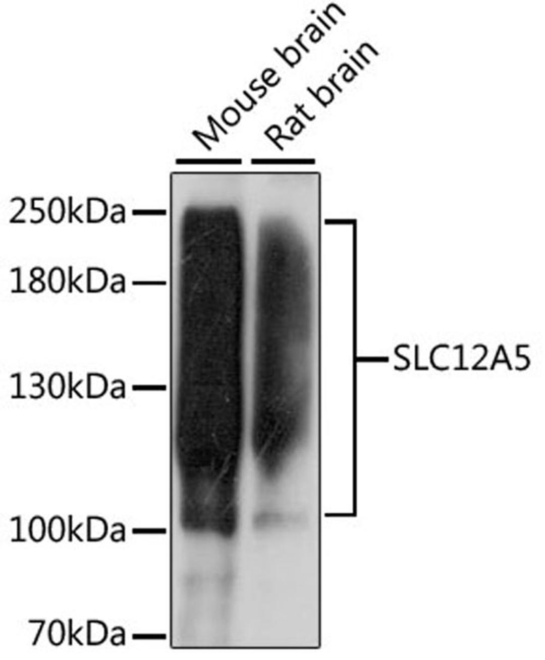 Western blot - SLC12A5 antibody (A15486)