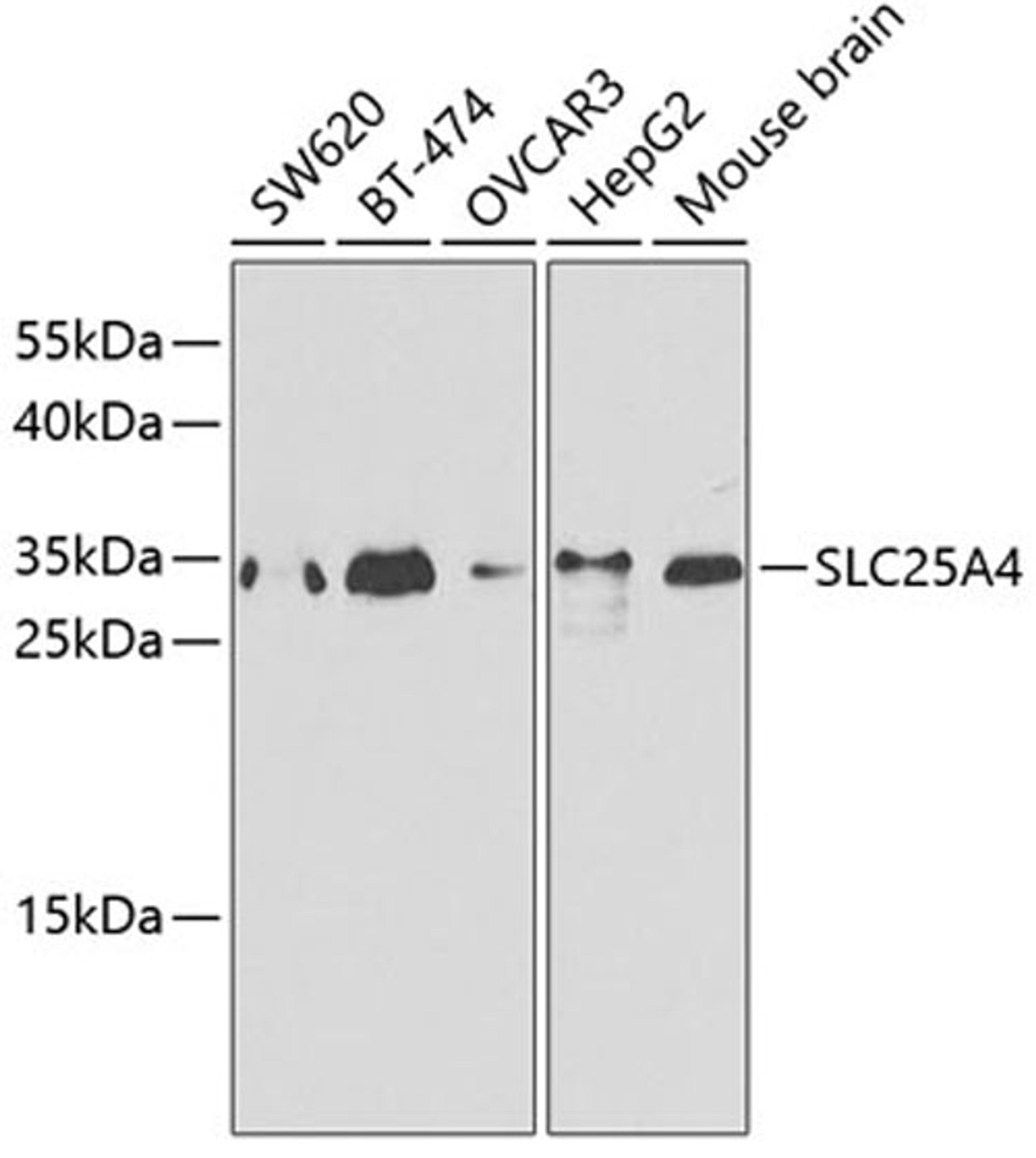 Western blot - SLC25A4 antibody (A1882)