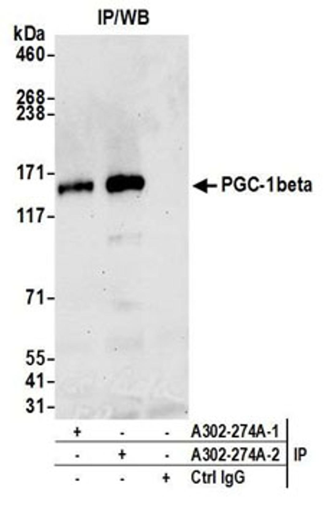 Detection of human PGC-1beta by western blot of immunoprecipitates.