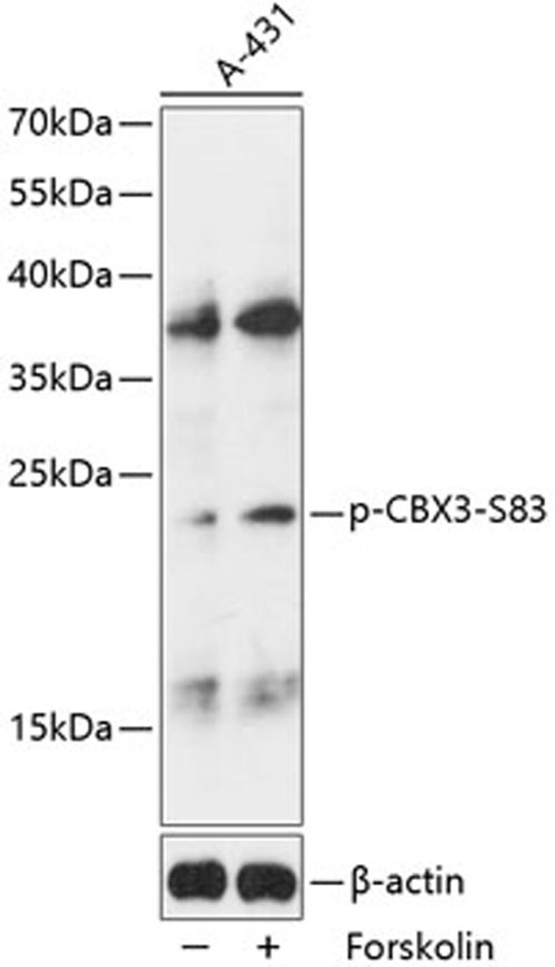 Western blot - Phospho-CBX3-S83 antibody (AP0801)