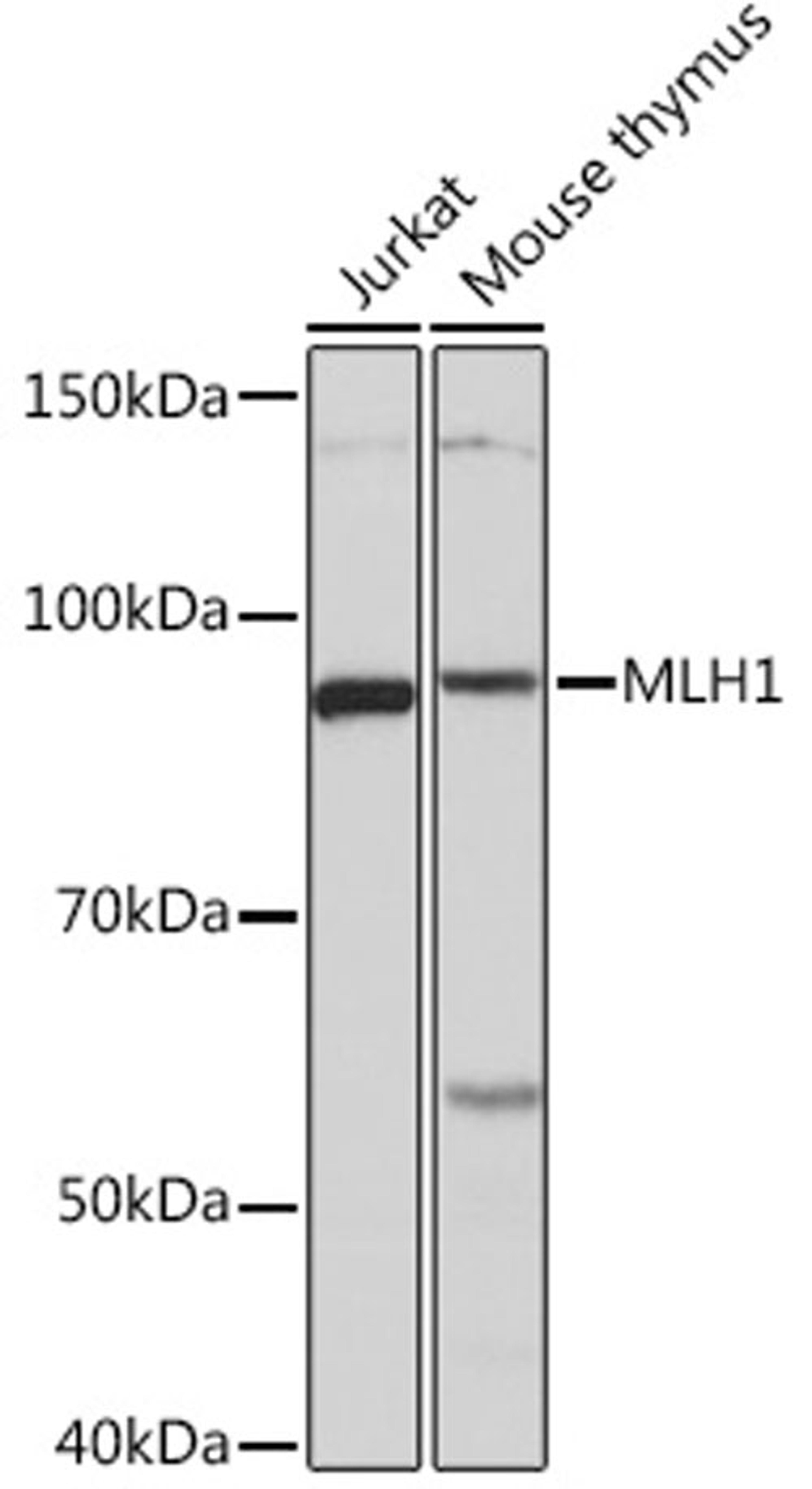 Western blot - MLH1 Rabbit mAb (A4858)