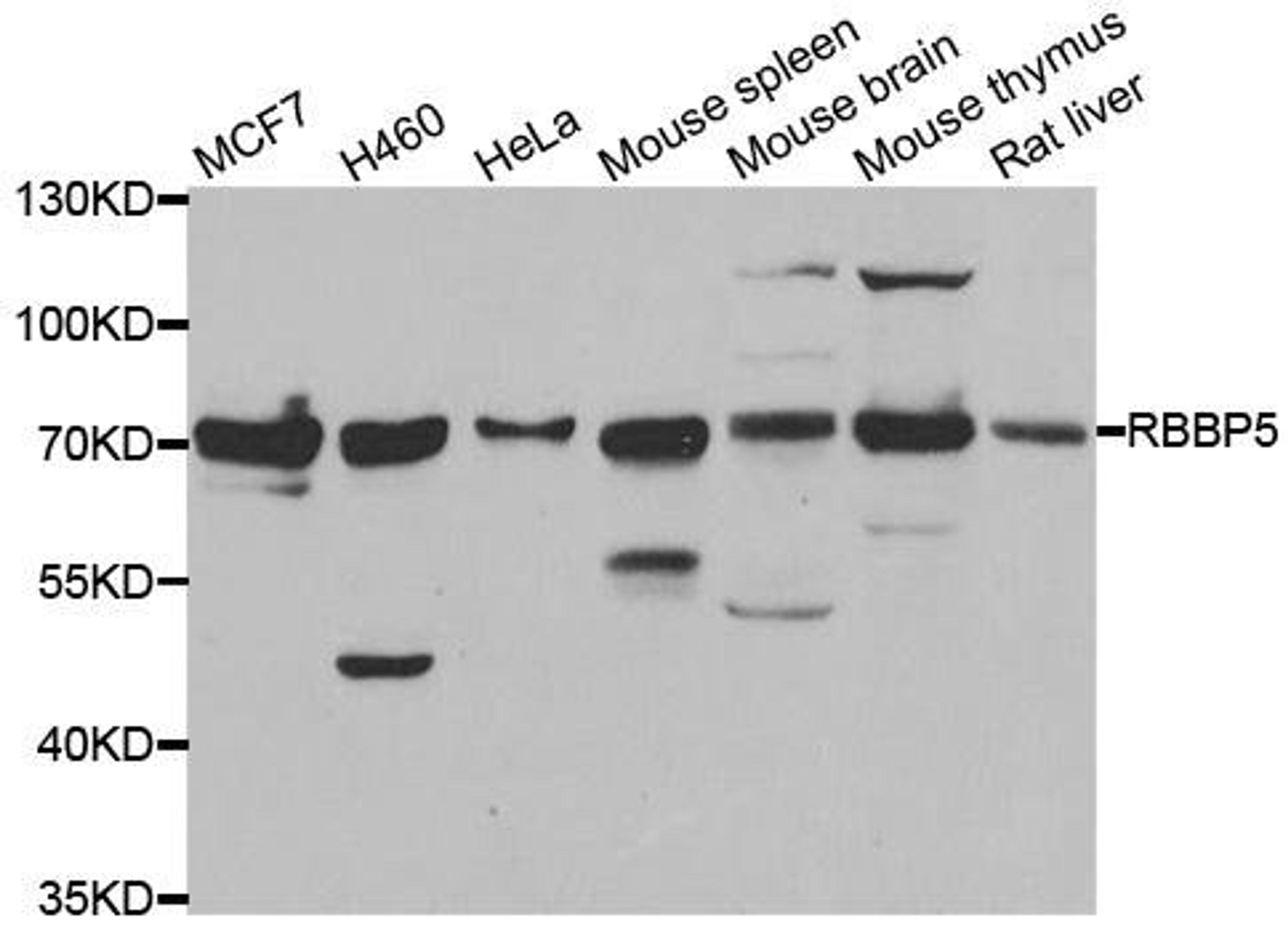 Western blot analysis of extracts of various cell lines using RBBP5 antibody