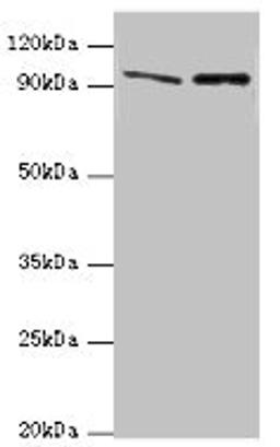 Western blot. All lanes: NVL antibody at 10ug/ml. Lane 1: Mouse thymus tissue. Lane 2: Hela whole cell lysate. Secondary. Goat polyclonal to rabbit IgG at 1/10000 dilution. Predicted band size: 96, 83, 73, 74, 86 kDa. Observed band size: 96 kDa. 