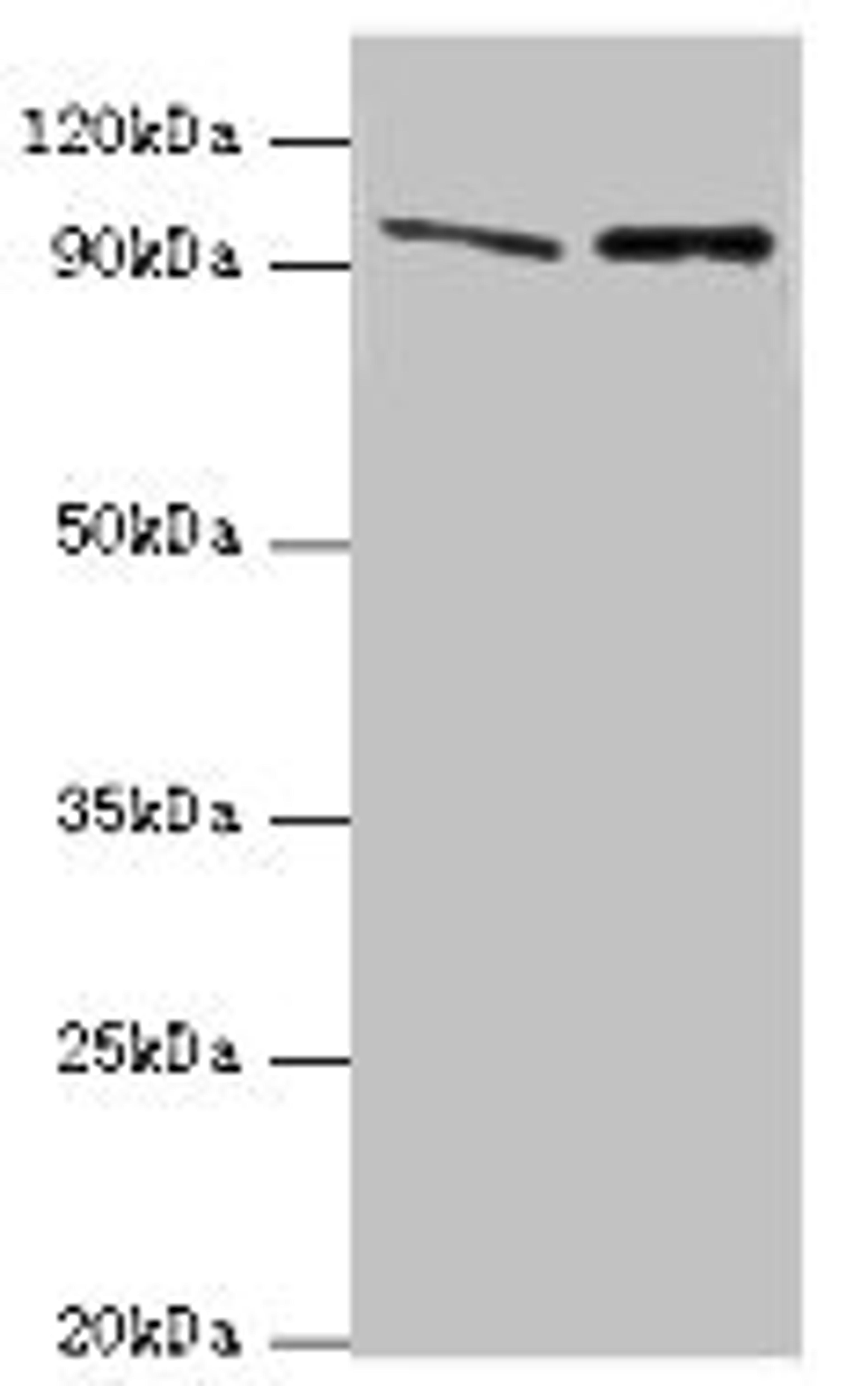 Western blot. All lanes: NVL antibody at 10ug/ml. Lane 1: Mouse thymus tissue. Lane 2: Hela whole cell lysate. Secondary. Goat polyclonal to rabbit IgG at 1/10000 dilution. Predicted band size: 96, 83, 73, 74, 86 kDa. Observed band size: 96 kDa. 