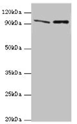 Western blot. All lanes: NVL antibody at 10ug/ml. Lane 1: Mouse thymus tissue. Lane 2: Hela whole cell lysate. Secondary. Goat polyclonal to rabbit IgG at 1/10000 dilution. Predicted band size: 96, 83, 73, 74, 86 kDa. Observed band size: 96 kDa.