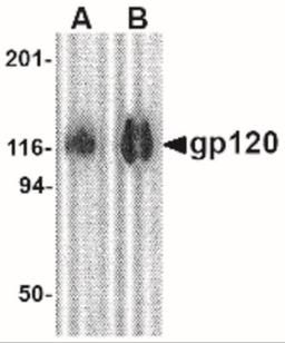 Western Blot: HIV-1 gp120 Antibody [NBP1-76371] - Western blot analysis of 1 ug of gp120 with gp120 antibody at (A) 0.5 and (B) 1 ug/mL.