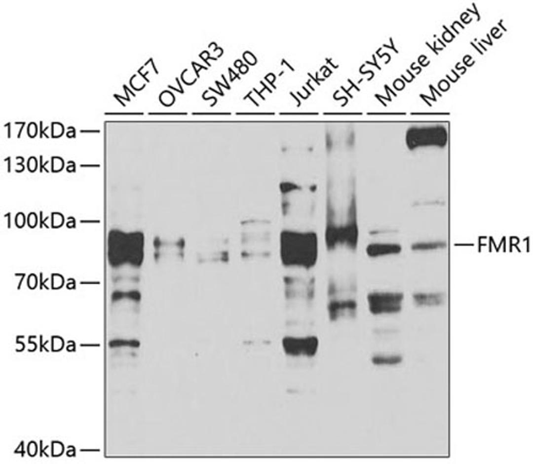 Western blot - FMR1 antibody (A5645)