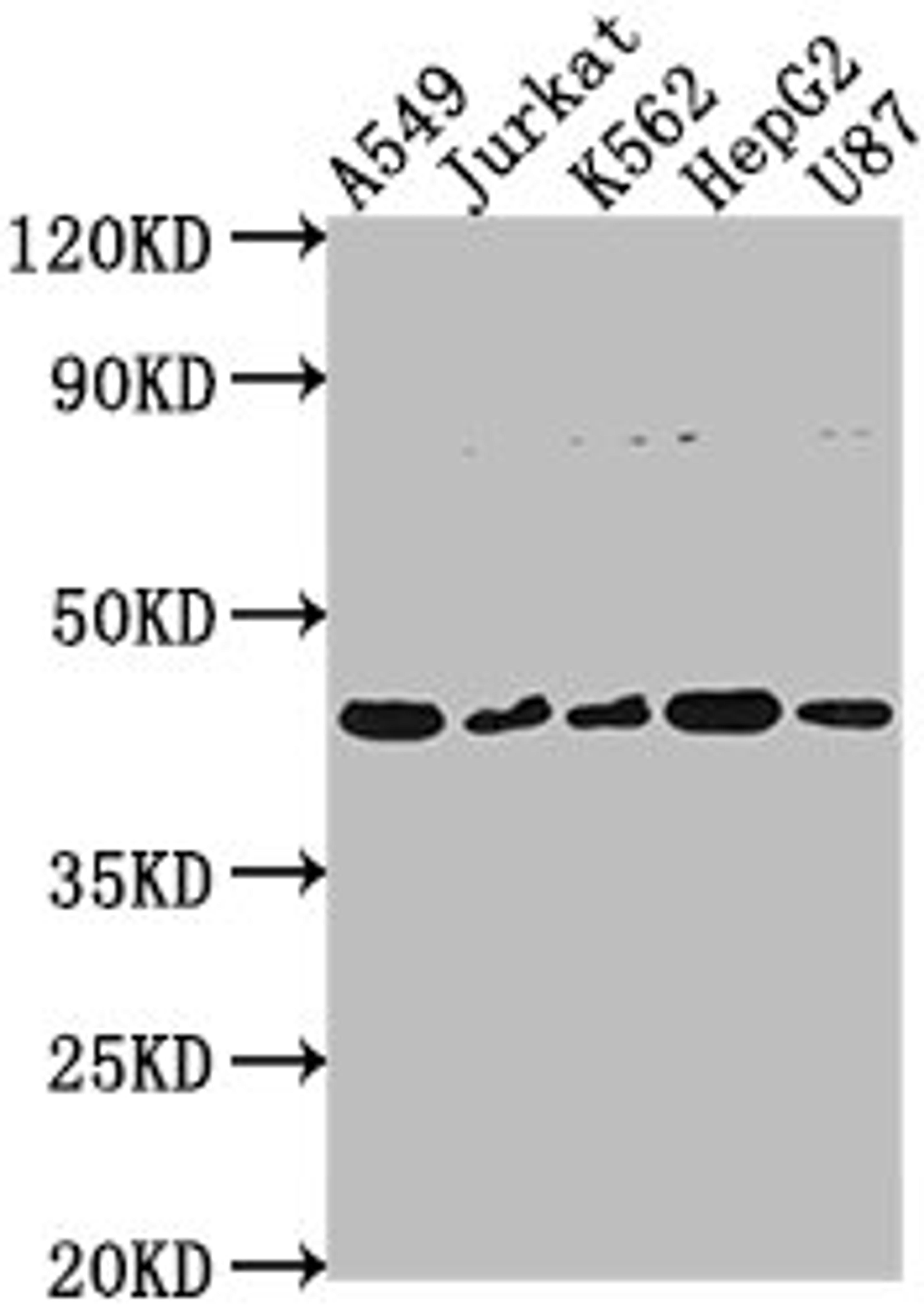 Western Blot. Positive WB detected in: A549 whole cell lysate, Jurkat whole cell lysate, K562 whole cell lysate, HepG2 whole cell lysate, U87 whole cell lysate. All lanes: DNASE2B antibody at 1:2000. Secondary. Goat polyclonal to rabbit IgG at 1/50000 dilution. Predicted band size: 42, 18 kDa. Observed band size: 42 kDa. 