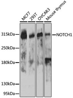 Western blot - NOTCH1 antibody (A7636)