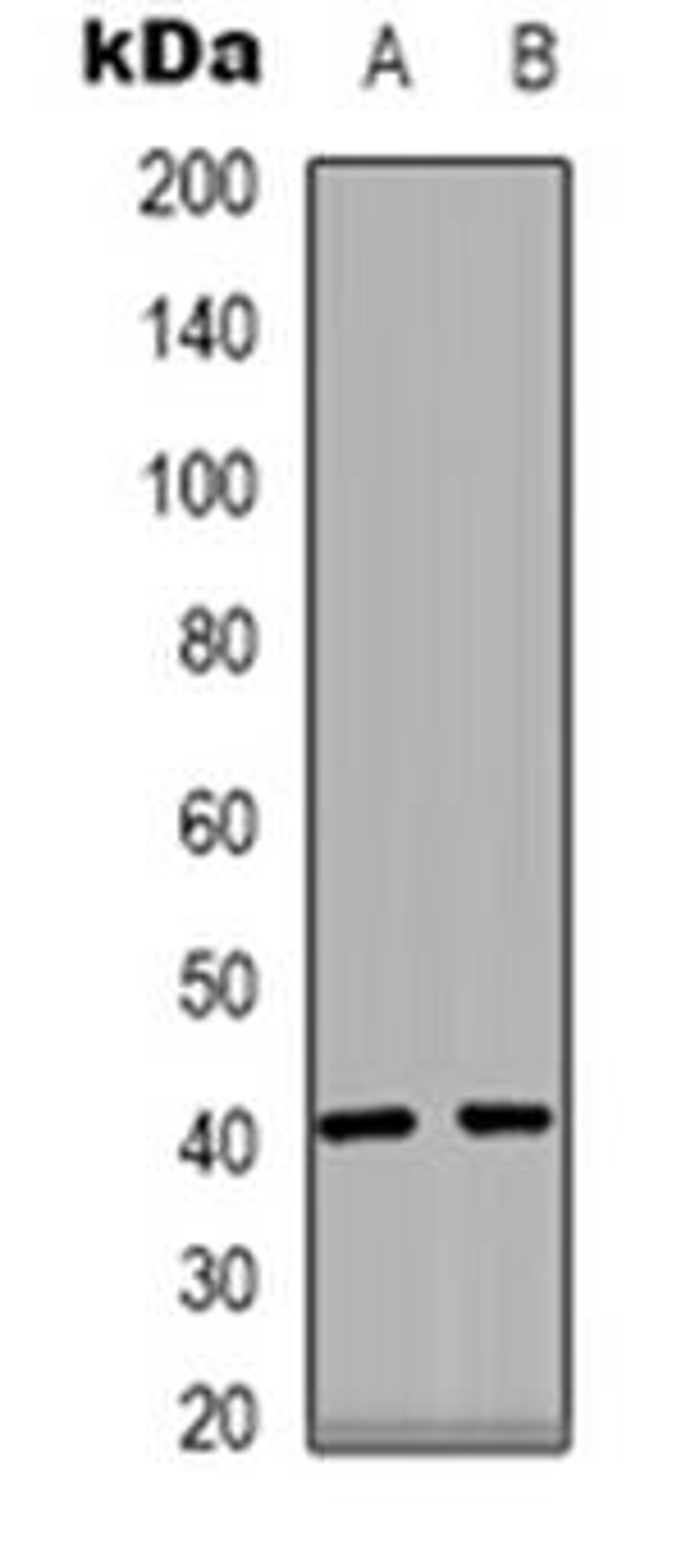 Western blot analysis of PPM1K expression in HEK293T (Lane 1), human heart (Lane 2) whole cell lysates using PPM1K antibody