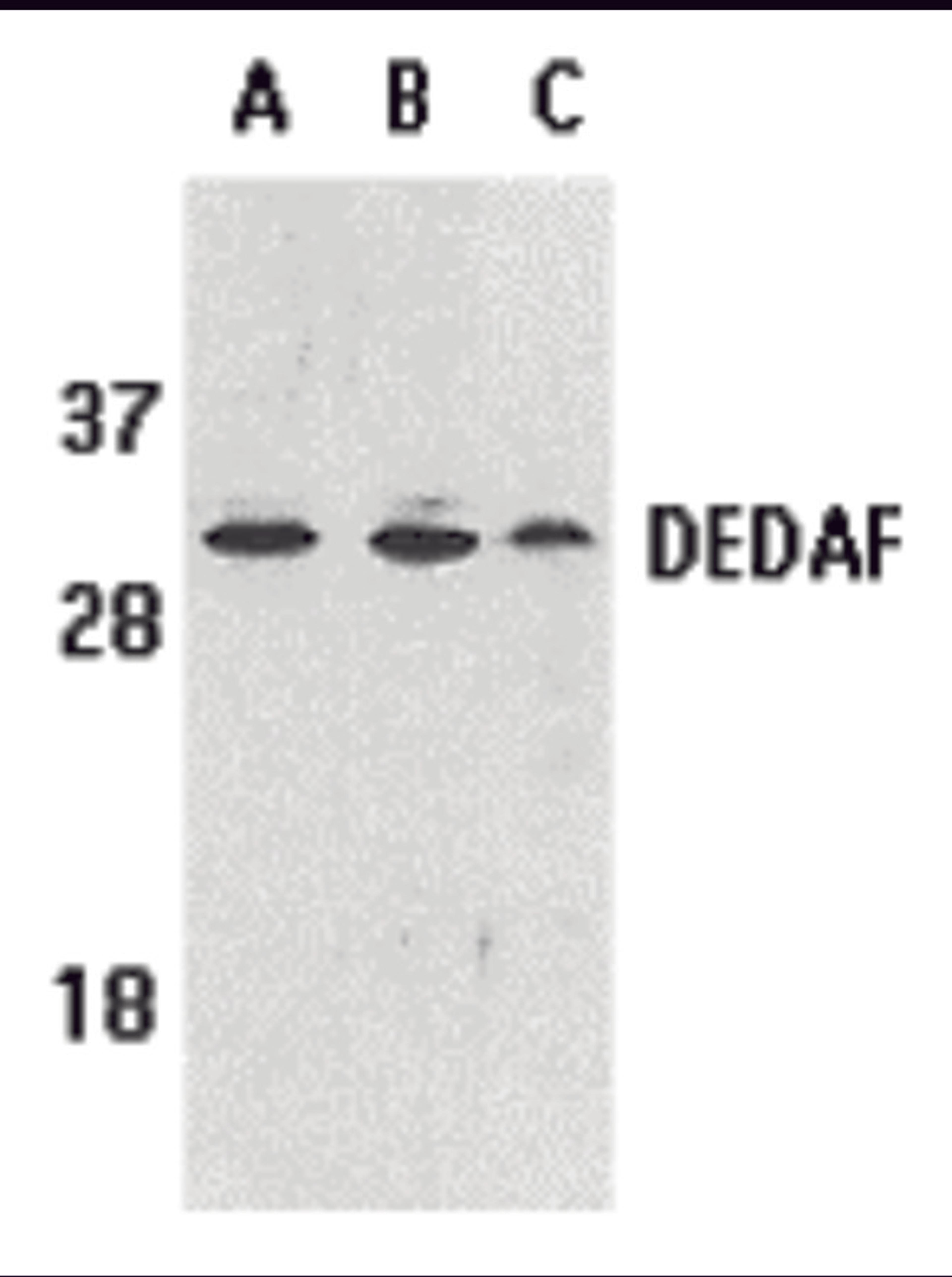 Western blot analysis of DEDAF expression in human A549 (lane A), HepG2 (lane B), and mouse 3T3 (lane C) cell lysates with DEDAF antibody at 1 &#956;g /ml.