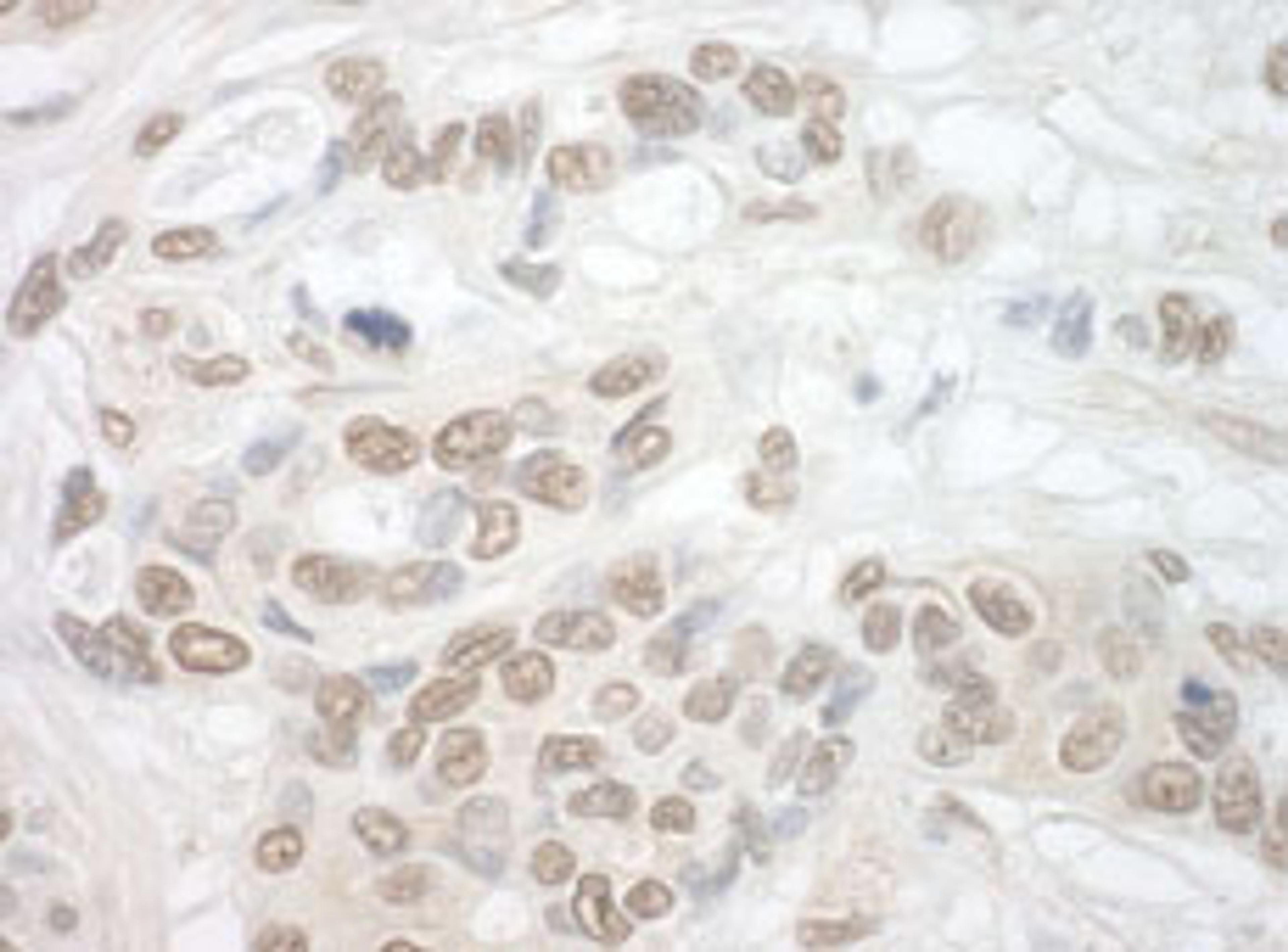 Detection of human TDRD3 by immunohistochemistry.