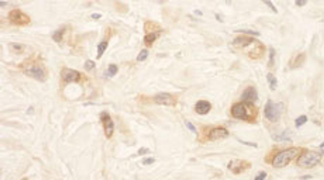 Detection of human SPAK by immunohistochemistry.