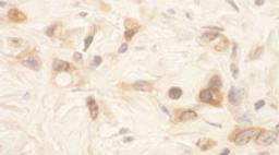 Detection of human SPAK by immunohistochemistry.