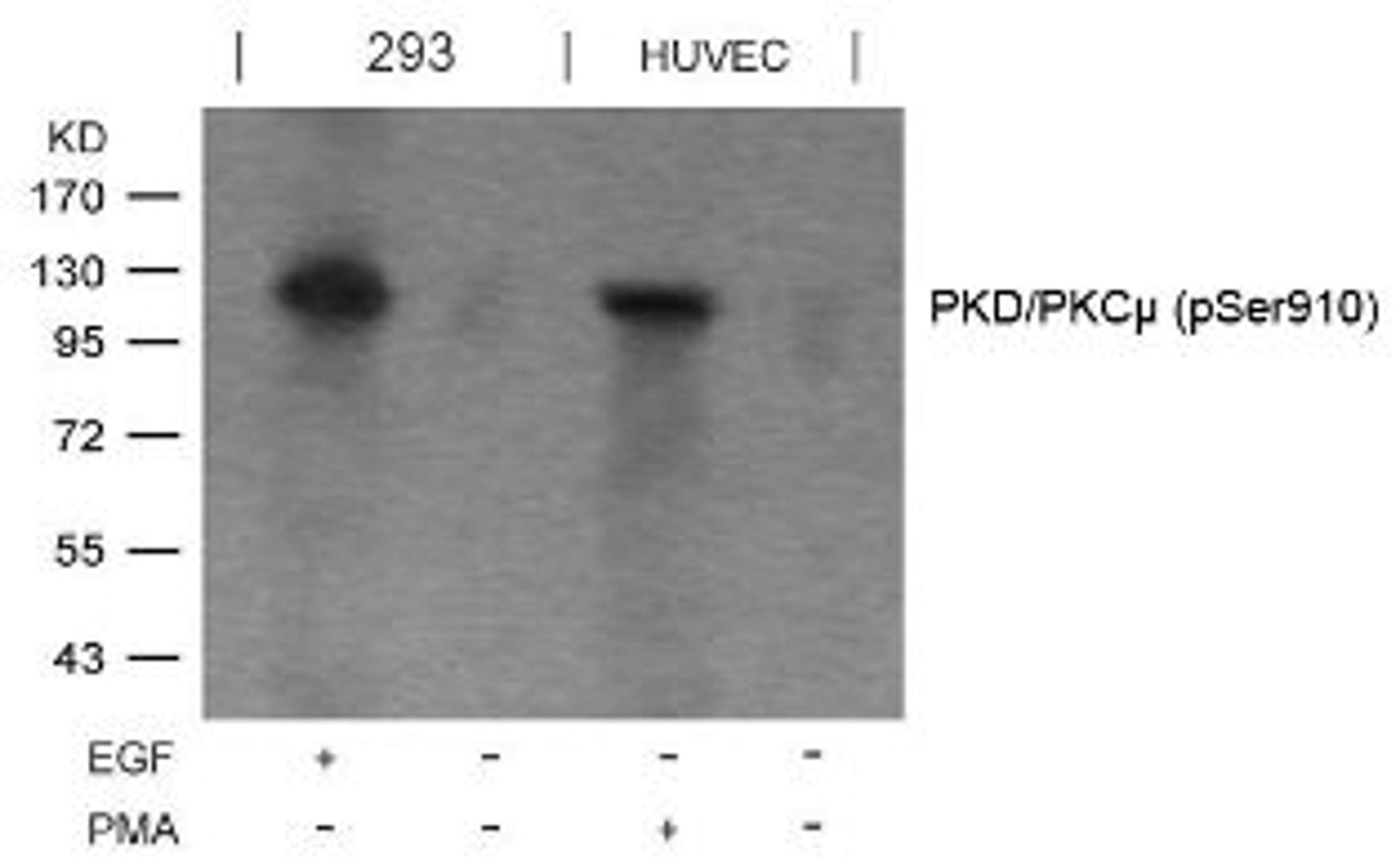 Western blot analysis of lysed extracts from EGF-treated 293 and PMA-treated HUVEC cells using PKD/PKC&#956; (Phospho-Ser910).