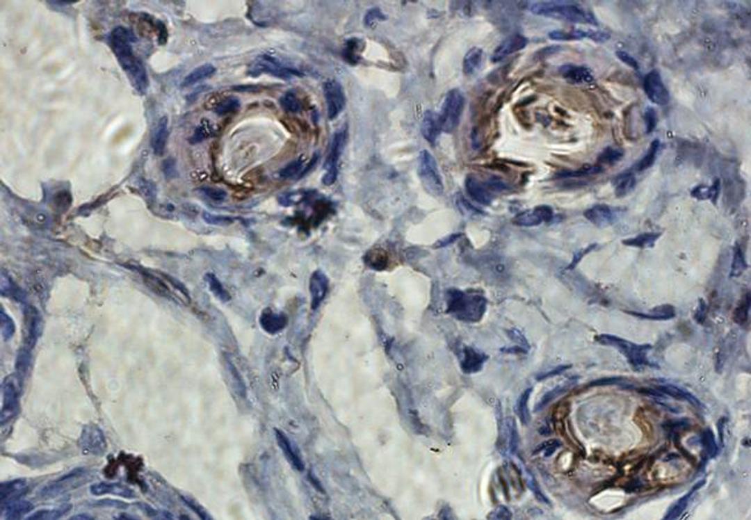 Immunohistochemical staining of paraffin embedded mouse skin tissue using TIMP1 antibody (primary antibody at 1:100)