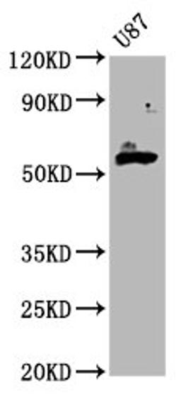 Western Blot. Positive WB detected in: U87 whole cell lysate. All lanes: GPT2 antibody at 4.5µg/ml. Secondary. Goat polyclonal to rabbit IgG at 1/50000 dilution. Predicted band size: 58, 47 kDa. Observed band size: 58 kDa