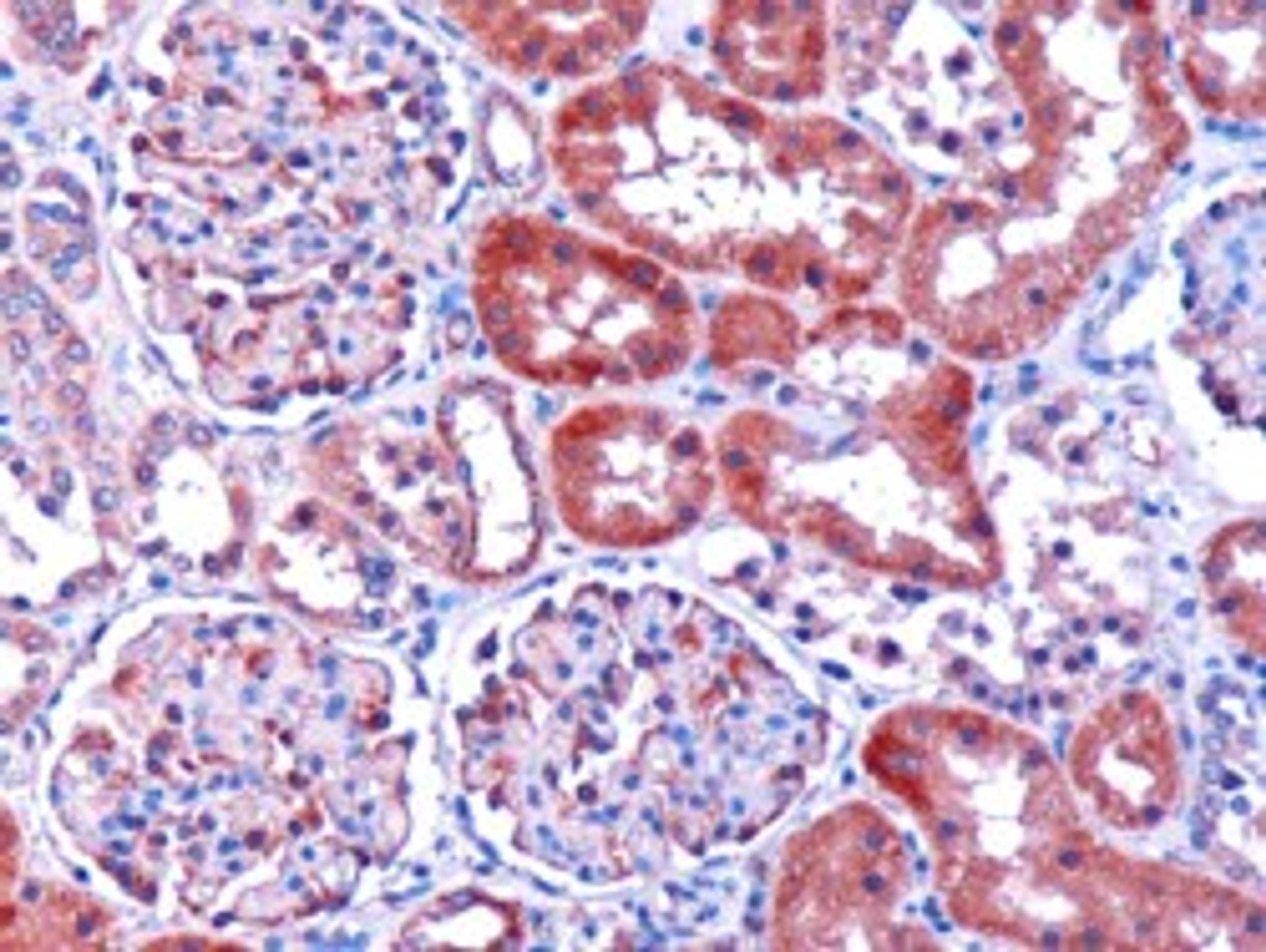 45-479 (1ug/ml) staining of paraffin embedded human kidney. Microwaved antigen retrieval with citrate buffer pH 6, HRP-staining.