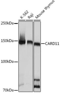 Western blot - CARD11 Rabbit mAb (A9652)