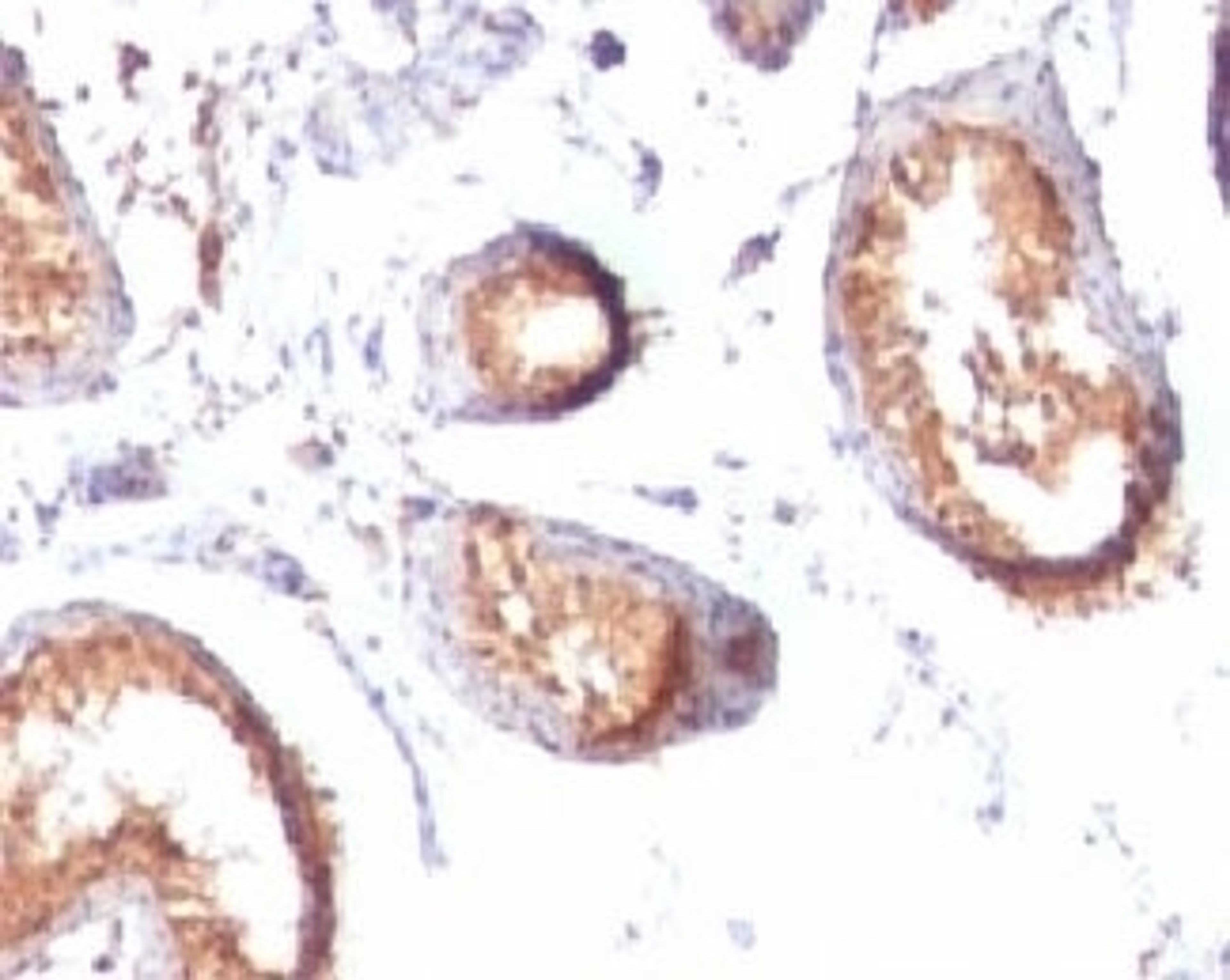 IHC testing of FFPE testis tissue with PMEL17 antibody (clone MSSG95).