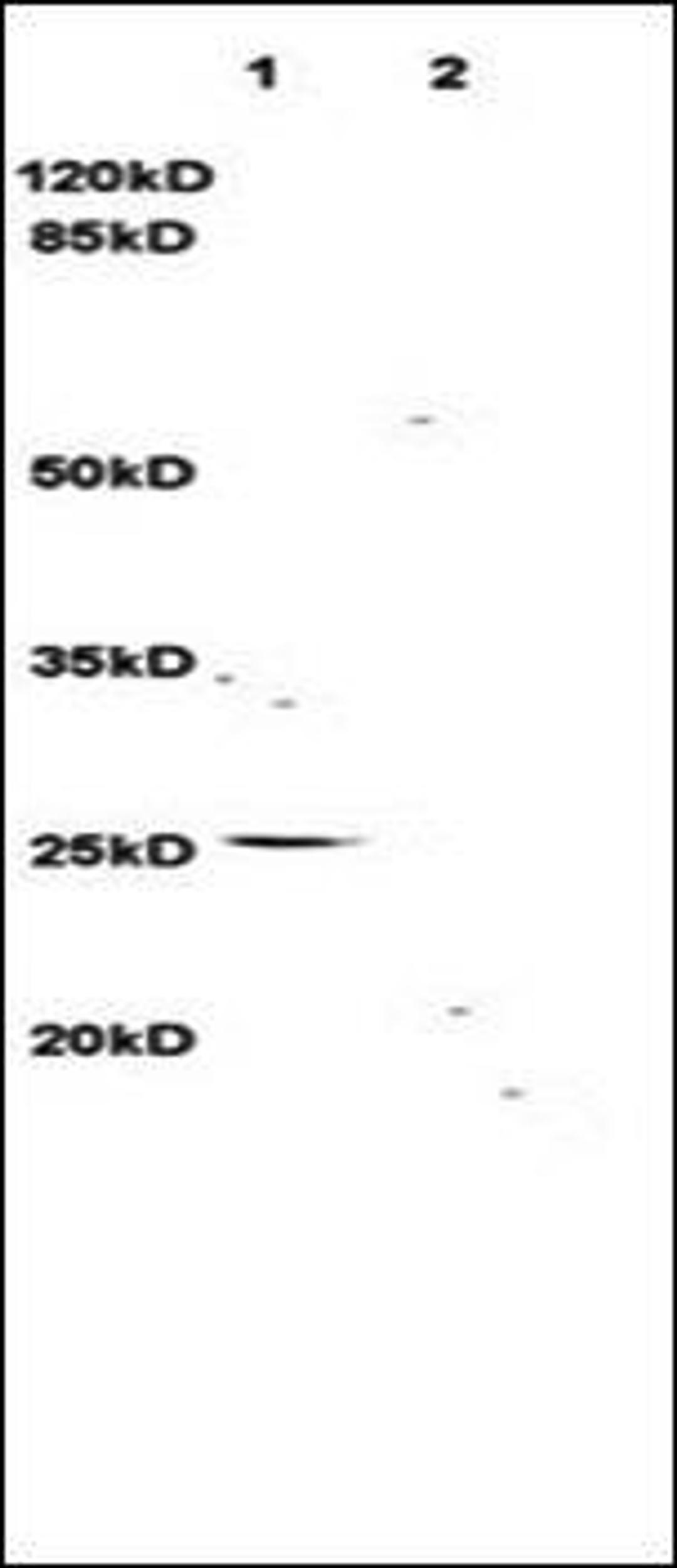 Western blot analysis of rat brain lysates (Lane1), rat kidney lysates (Lane2) dilution at:1:3000 using TNFSF14 antibody