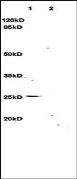 Western blot analysis of rat brain lysates (Lane1), rat kidney lysates (Lane2) dilution at:1:3000 using TNFSF14 antibody