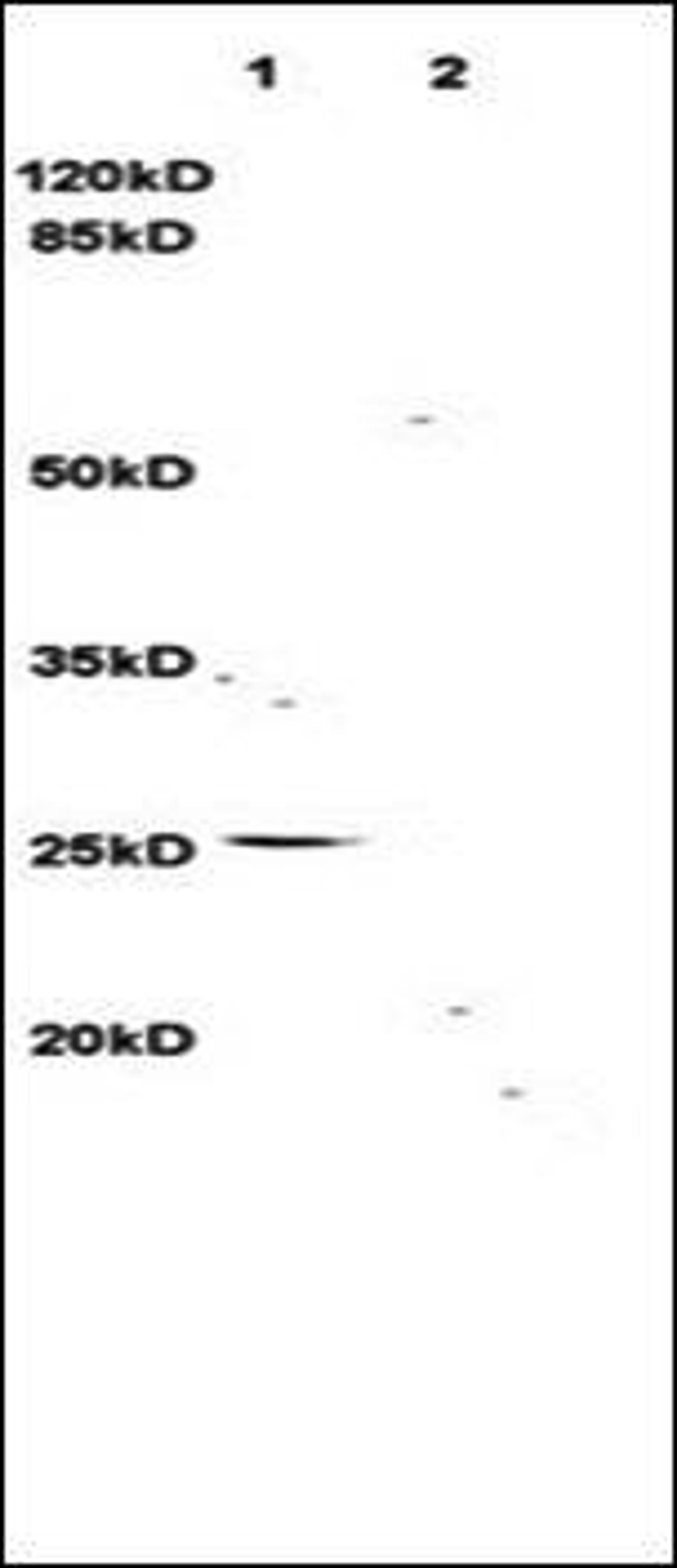 Western blot analysis of rat brain lysates (Lane1), rat kidney lysates (Lane2) dilution at:1:3000 using TNFSF14 antibody