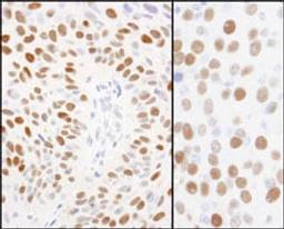 Detection of human and mouse Phospho MCM2 (S108) by immunohistochemistry.