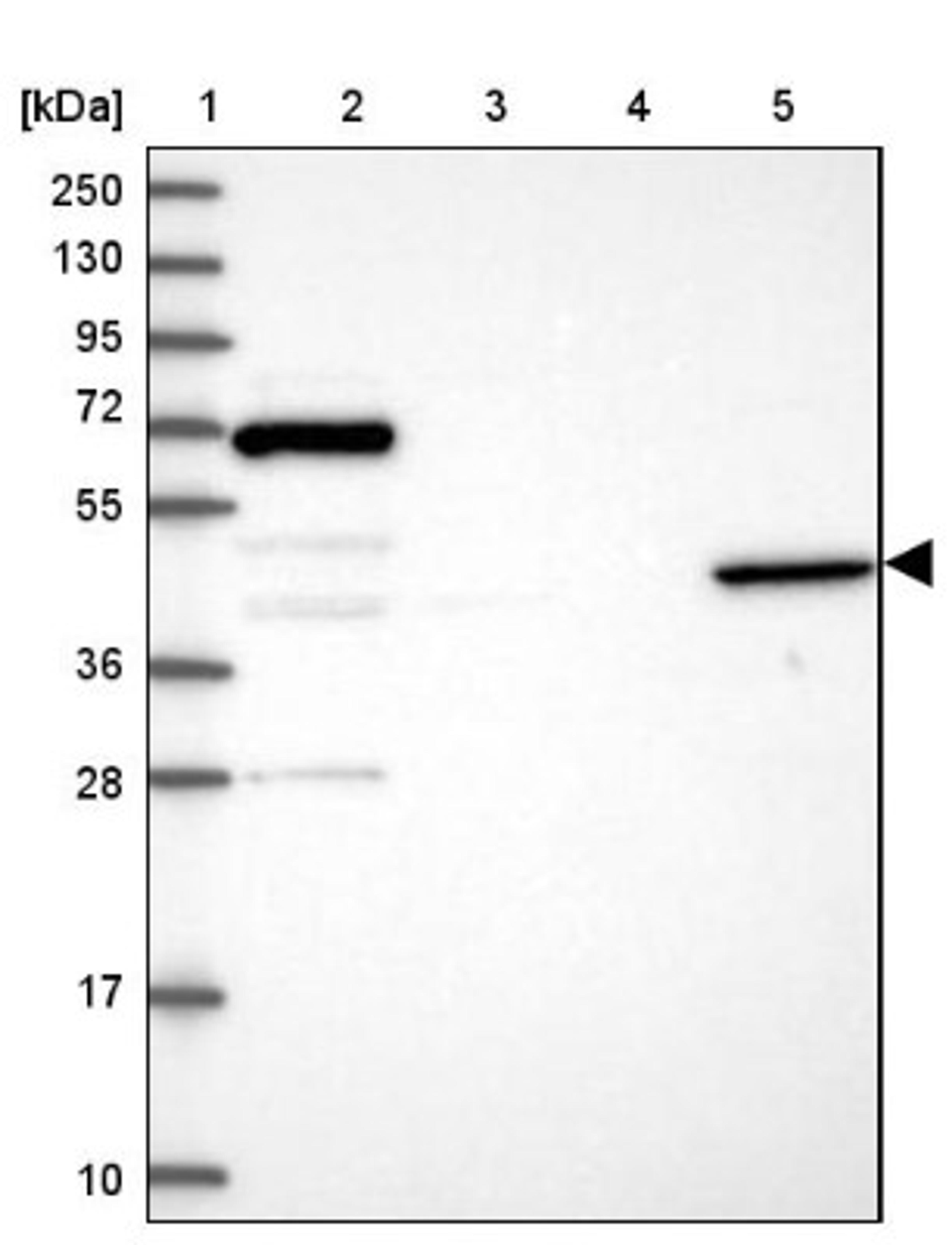 Western Blot: ANGPTL5 Antibody [NBP1-85870] - Lane 1: Marker [kDa] 250, 130, 95, 72, 55, 36, 28, 17, 10<br/>Lane 2: Human cell line RT-4<br/>Lane 3: Human cell line U-251MG sp<br/>Lane 4: Human plasma (IgG/HSA depleted)<br/>Lane 5: Human liver tissue