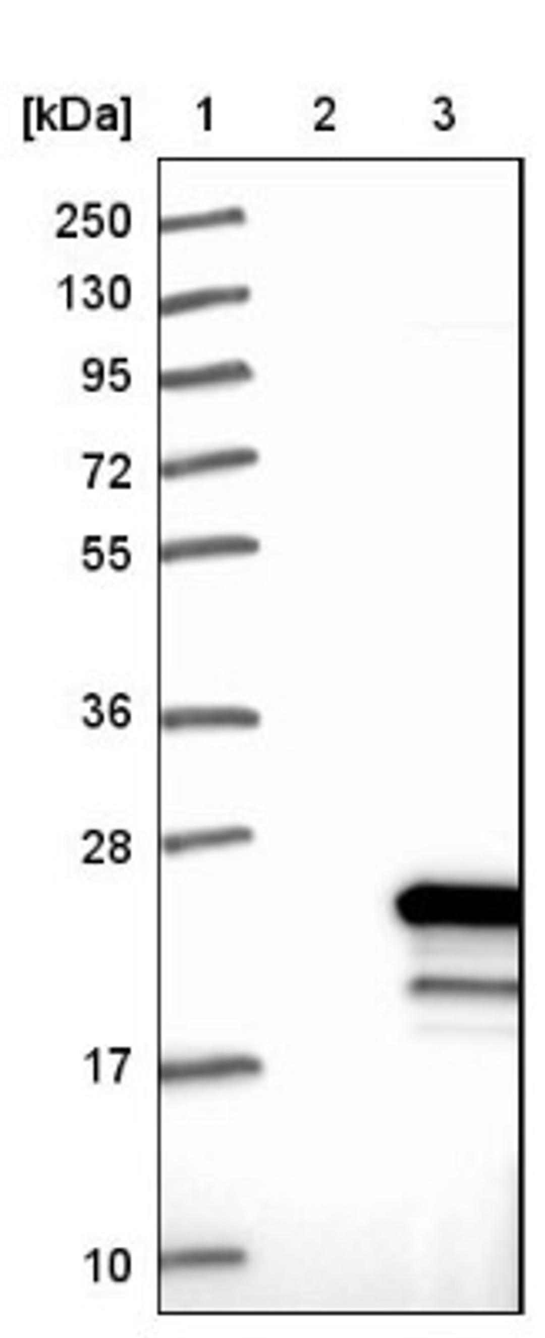 Western Blot: beta-Synuclein Antibody [NBP1-90342] - Lane 1: Marker [kDa] 250, 130, 95, 72, 55, 36, 28, 17, 10<br/>Lane 2: Negative control (vector only transfected HEK293T lysate)<br/>Lane 3: Over-expression lysate (Co-expressed with a C-terminal myc-DDK tag (~3.1 kDa) in mammalian HEK293T cells, LY401075)