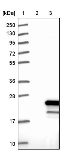 Western Blot: beta-Synuclein Antibody [NBP1-90342] - Lane 1: Marker [kDa] 250, 130, 95, 72, 55, 36, 28, 17, 10<br/>Lane 2: Negative control (vector only transfected HEK293T lysate)<br/>Lane 3: Over-expression lysate (Co-expressed with a C-terminal myc-DDK tag (~3.1 kDa) in mammalian HEK293T cells, LY401075)