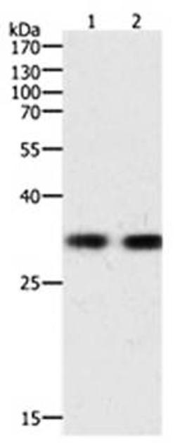 Western blot analysis of K562 cell lysate(Lane1 40ug) and Hela cell lysate(Lane2 40ug) at:1:700 dilution using HAVCR1 antibody