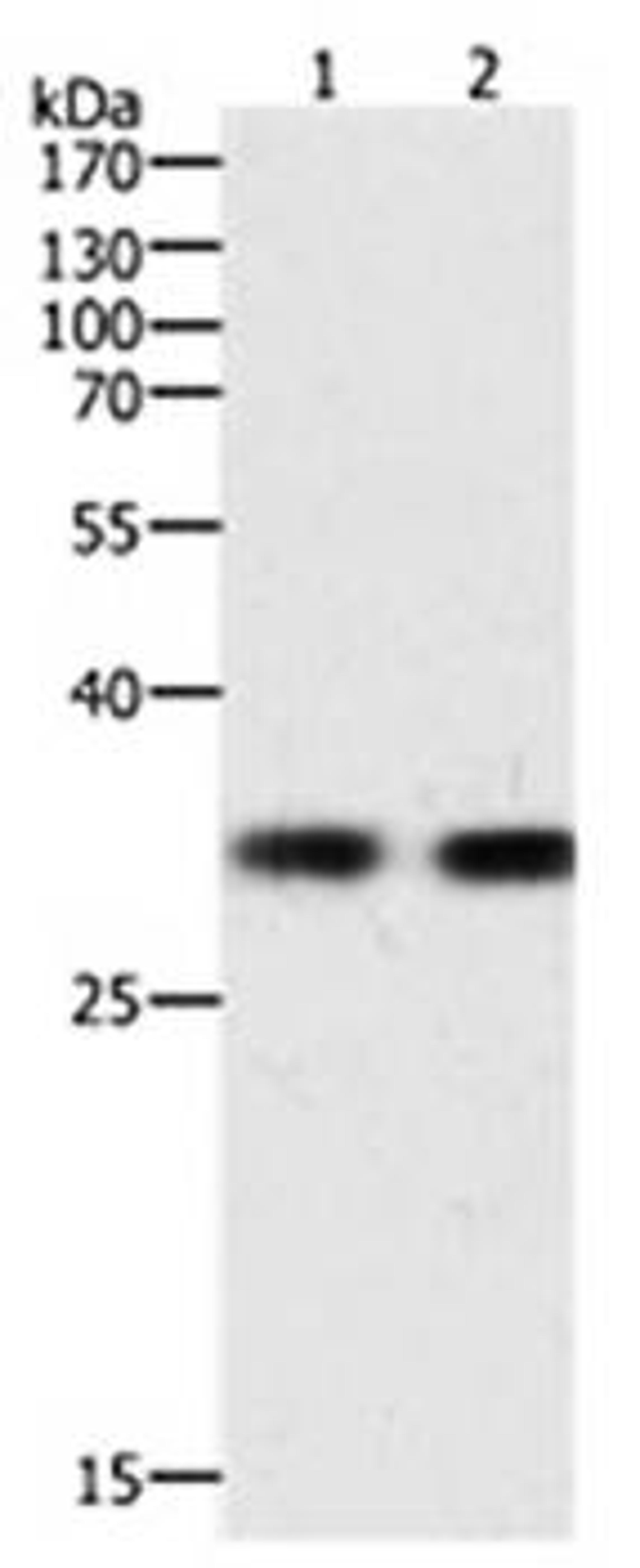 Western blot analysis of K562 cell lysate(Lane1 40ug) and Hela cell lysate(Lane2 40ug) at:1:700 dilution using HAVCR1 antibody