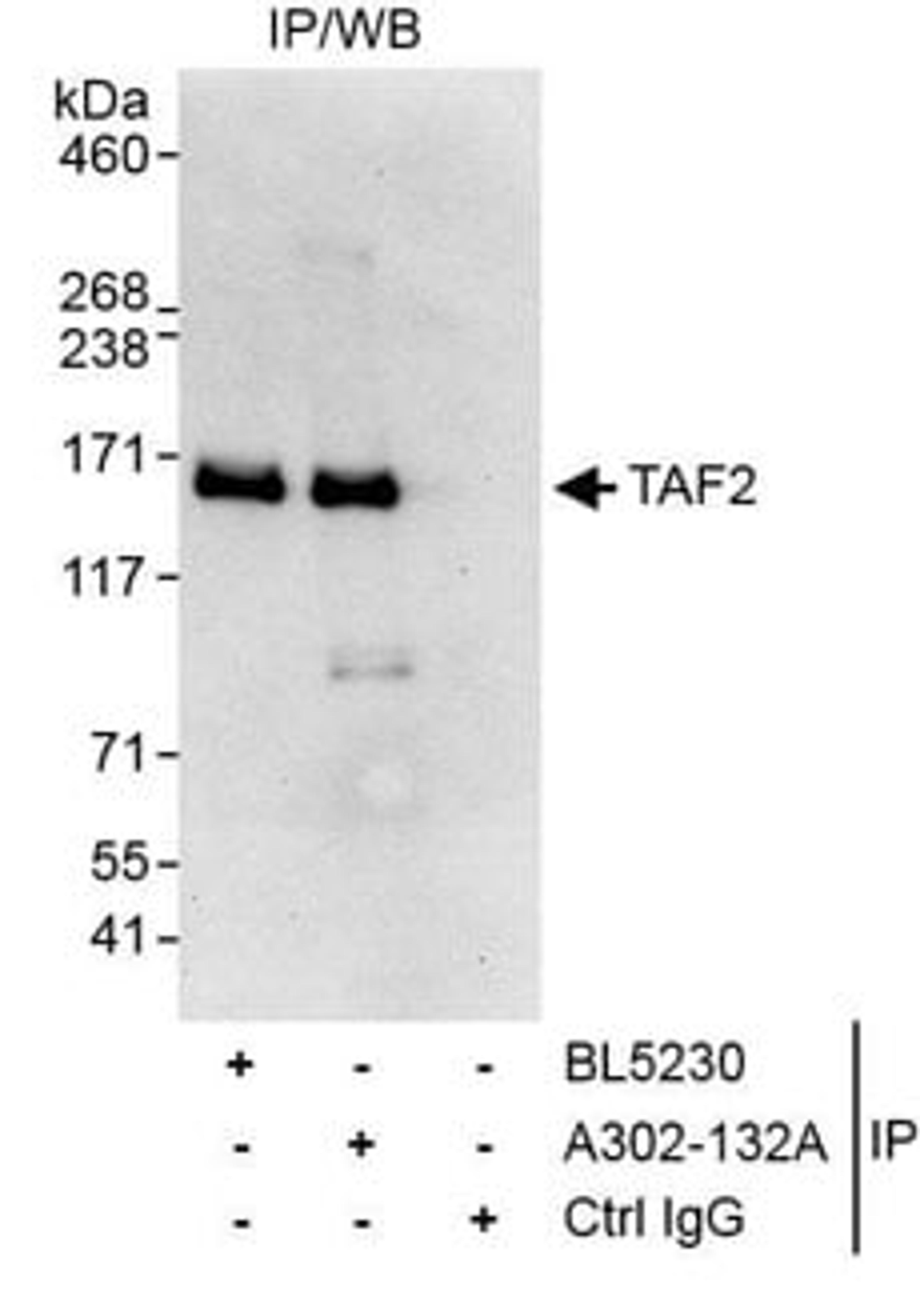 Detection of human TAF2 by western blot of immunoprecipitates.