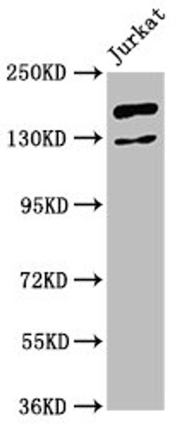 Western Blot. Positive WB detected in: Jurkat whole cell lysate. All lanes: CASZ1 antibody at 4.8ug/ml. Secondary. Goat polyclonal to rabbit IgG at 1/50000 dilution. Predicted band size: 191, 125 kDa. Observed band size: 191 kDa.