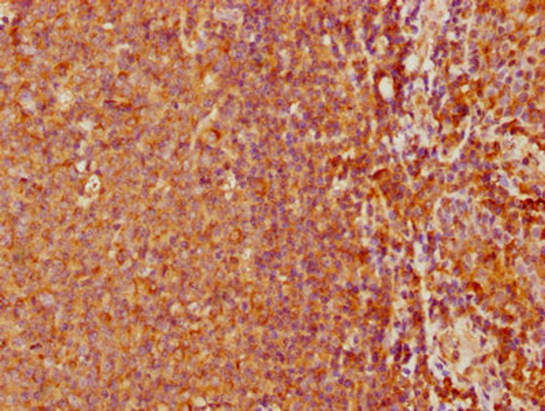 IHC image of CSB-PA617999LA01HU diluted at 1:500 and staining in paraffin-embedded human tonsil tissue performed on a Leica BondTM system. After dewaxing and hydration, antigen retrieval was mediated by high pressure in a citrate buffer (pH 6.0). Section was blocked with 10% normal goat serum 30min at RT. Then primary antibody (1% BSA) was incubated at 4°C overnight. The primary is detected by a biotinylated secondary antibody and visualized using an HRP conjugated SP system.