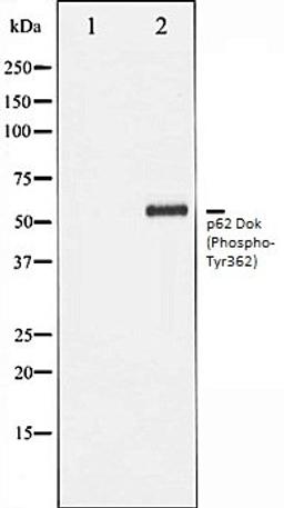 Western blot analysis of Jurkat whole cell lysates using p62 Dok (Phospho-Tyr362) antibody, The lane on the left is treated with the antigen-specific peptide.