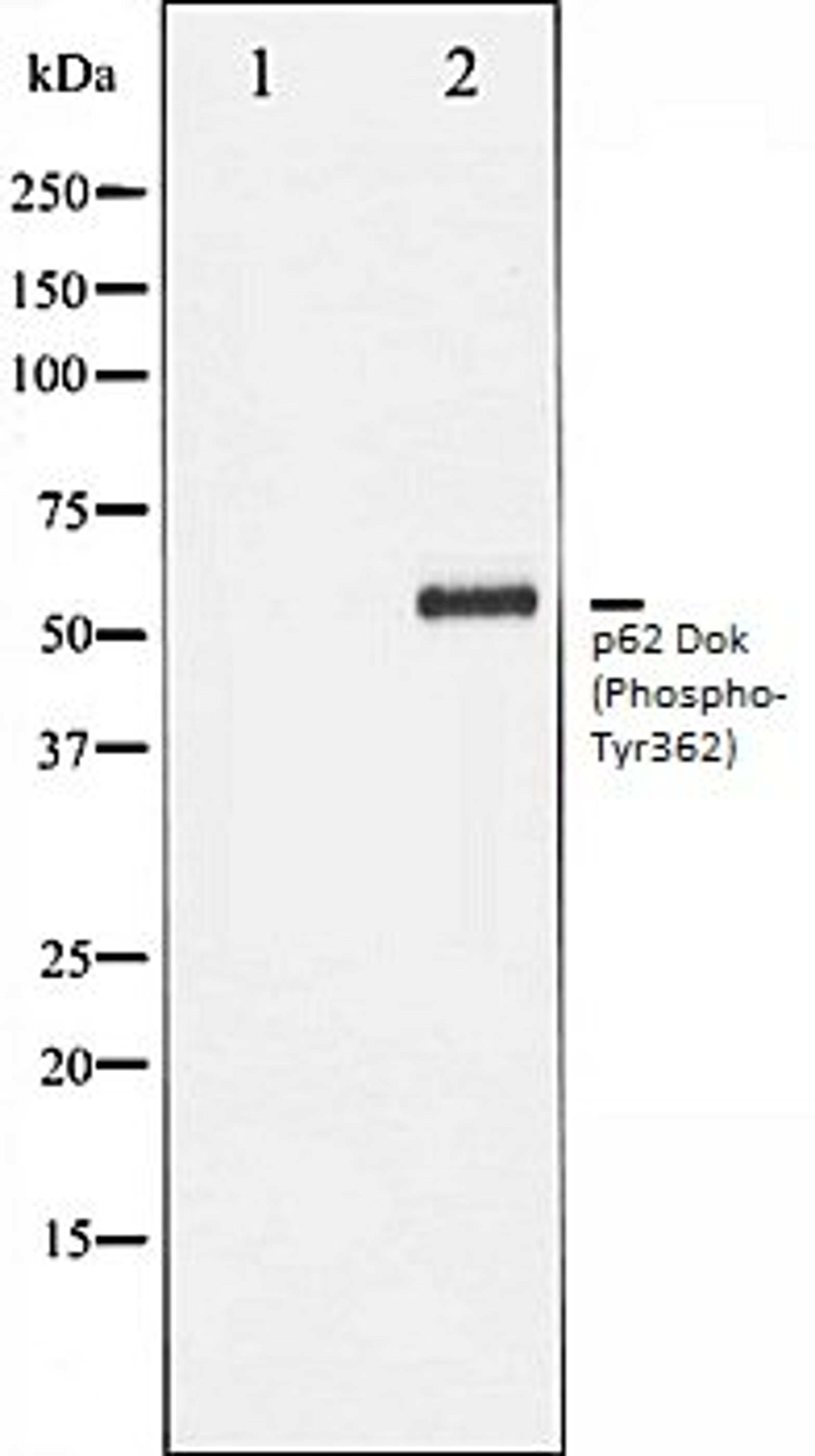 Western blot analysis of Jurkat whole cell lysates using p62 Dok (Phospho-Tyr362) antibody, The lane on the left is treated with the antigen-specific peptide.