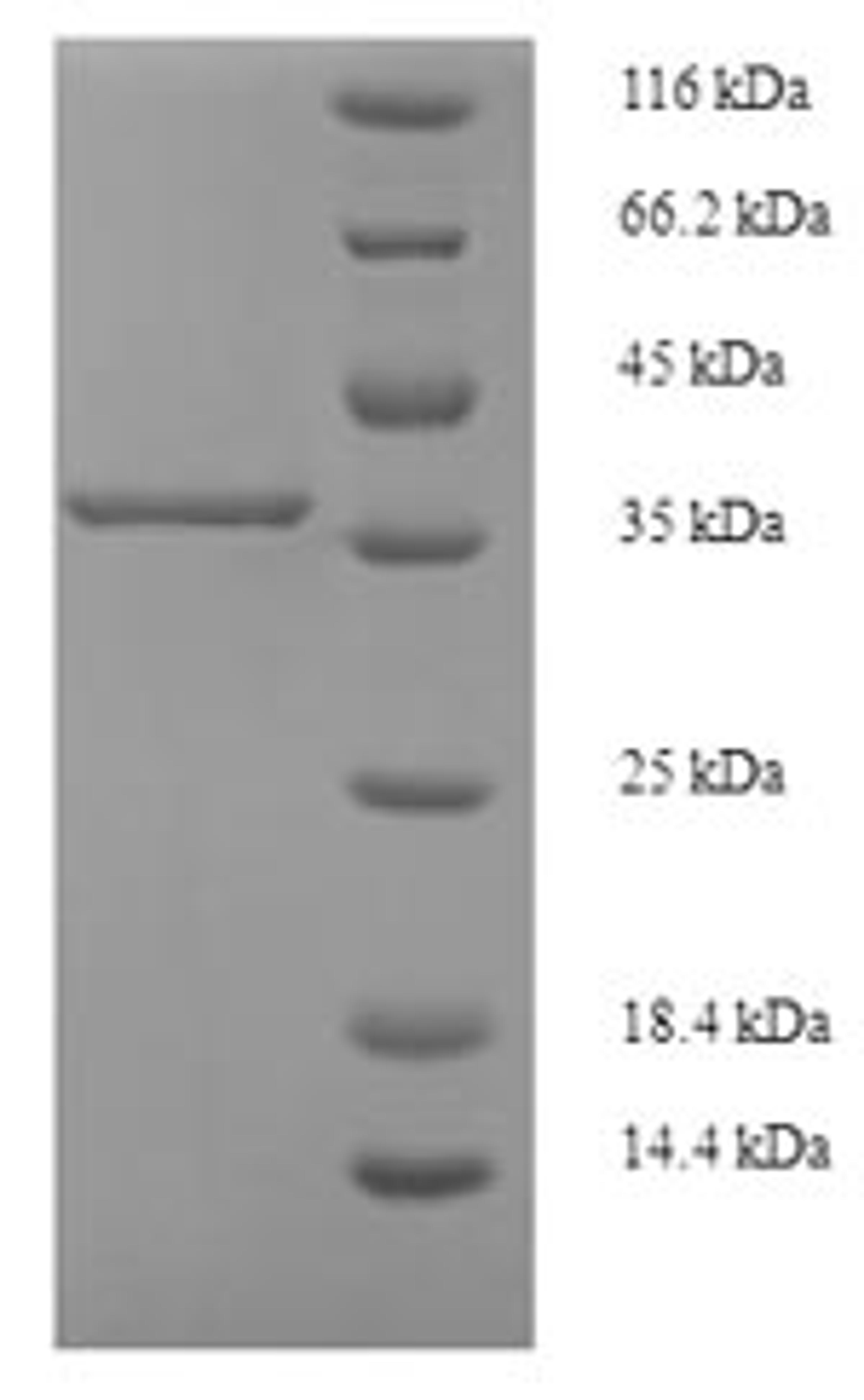 (Tris-Glycine gel) Discontinuous SDS-PAGE (reduced) with 5% enrichment gel and 15% separation gel.