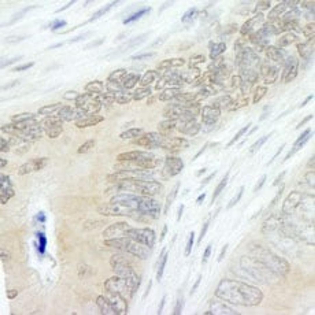 Detection of human Lasu1/Ureb1 by immunohistochemistry.