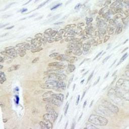 Detection of human Lasu1/Ureb1 by immunohistochemistry.