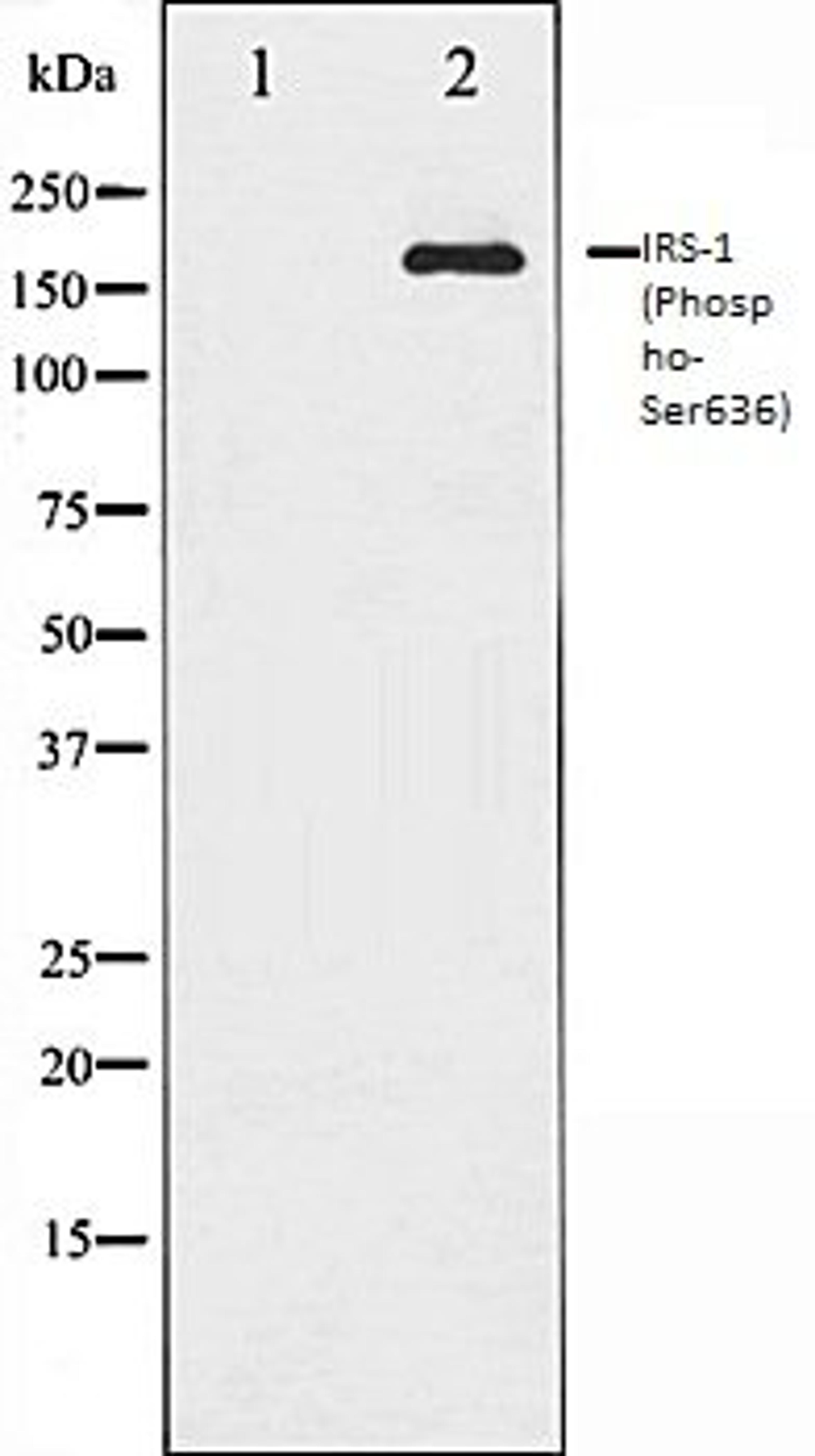 Western blot analysis of 293 whole cell lysates using IRS-1 (Phospho-Ser636) antibody, The lane on the left is treated with the antigen-specific peptide.