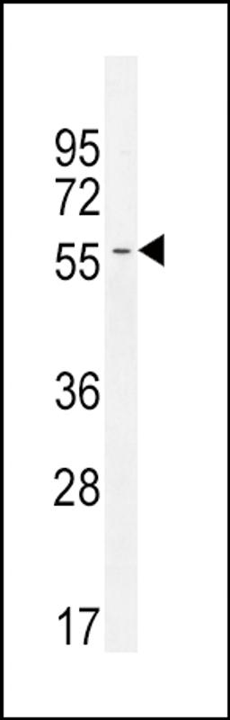 Western blot analysis in CEM cell line lysates (35ug/lane).