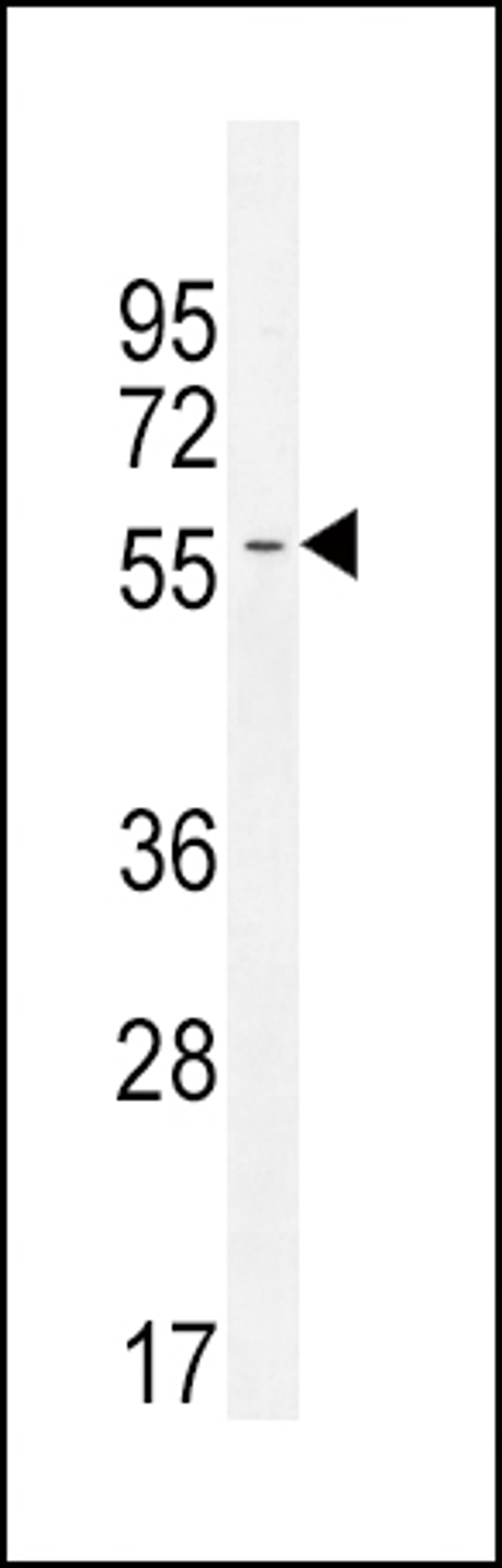 Western blot analysis in CEM cell line lysates (35ug/lane).