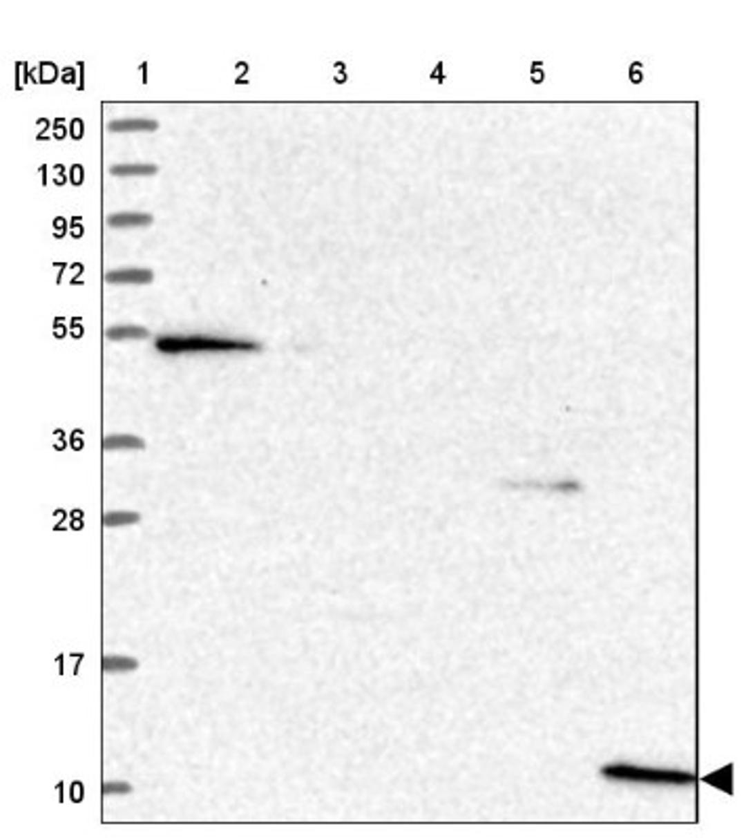 Western Blot: CRIP1 Antibody [NBP1-84380] - Lane 1: Marker [kDa] 250, 130, 95, 72, 55, 36, 28, 17, 10<br/>Lane 2: Human cell line RT-4<br/>Lane 3: Human cell line U-251MG sp<br/>Lane 4: Human plasma (IgG/HSA depleted)<br/>Lane 5: Human liver tissue<br/>Lane 6: Human tonsil tissue