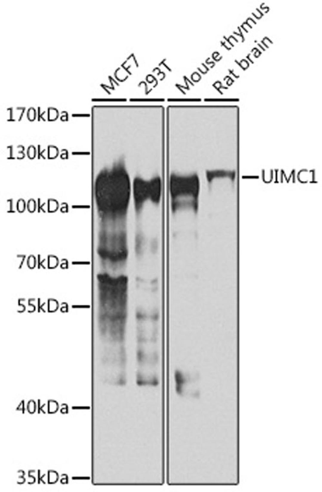 Western blot - UIMC1 antibody (A7244)