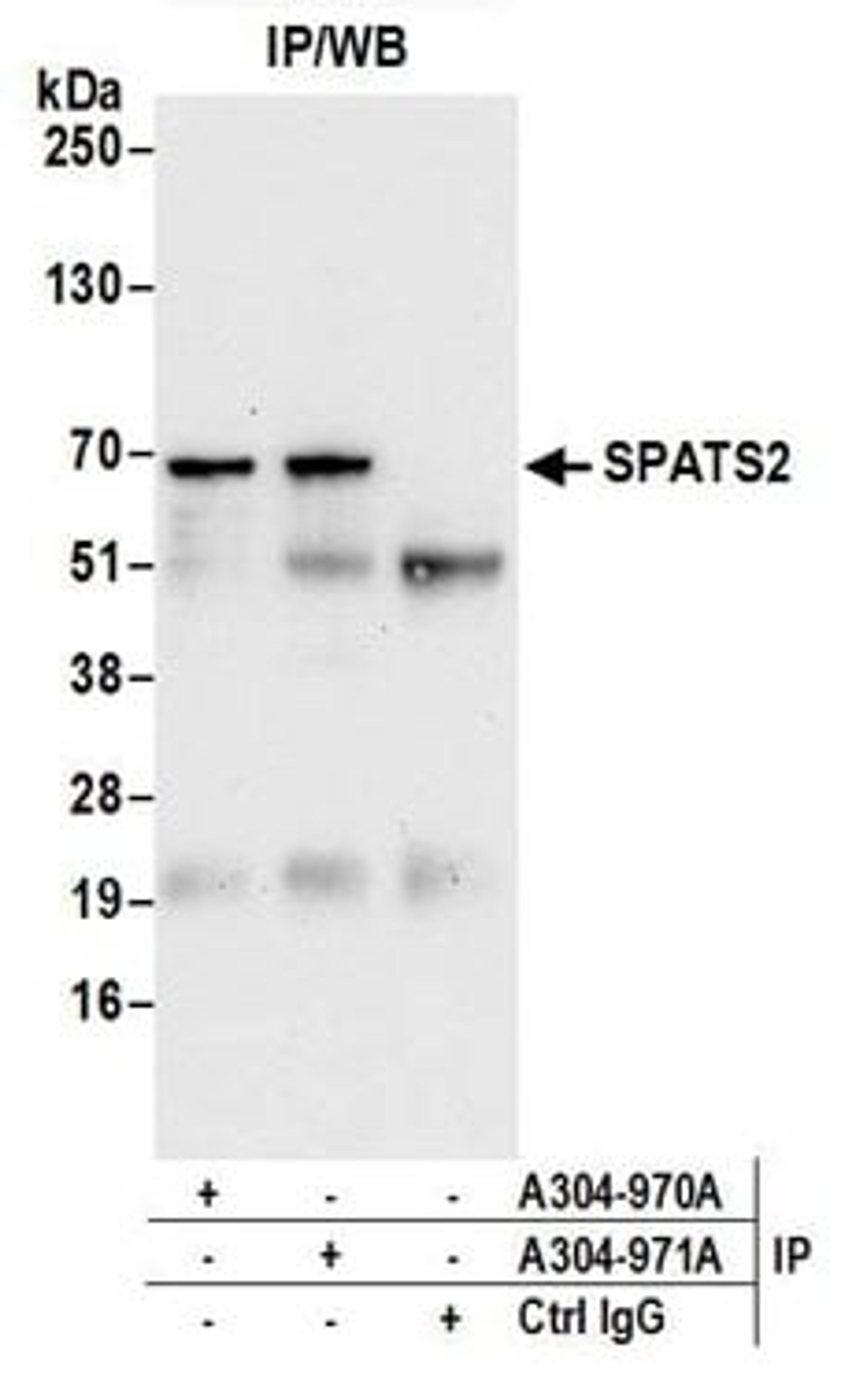 Detection of human SPATS2 by western blot of immunoprecipitates.