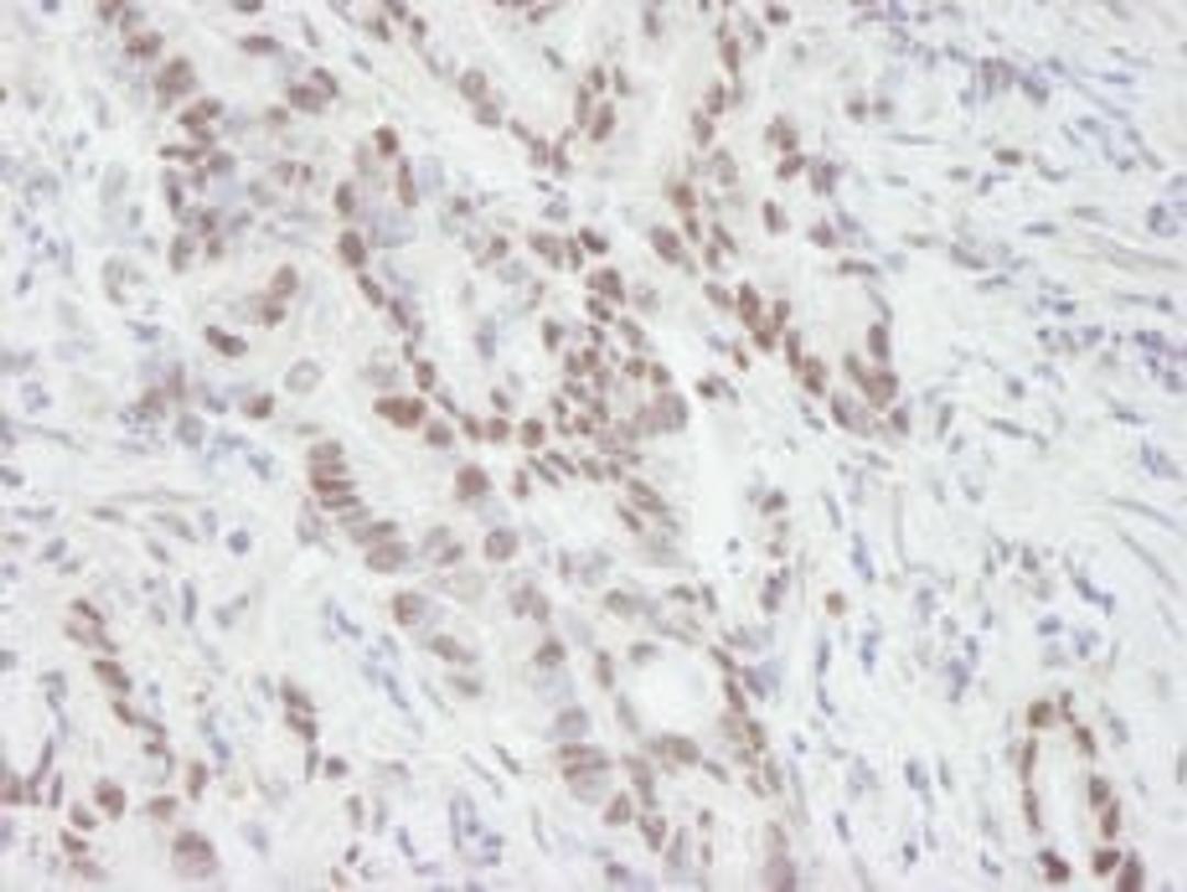 Detection of human MTA1 by immunohistochemistry.